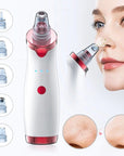 Facial Blackhead Remover Vacuum